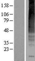 Neurokinin 1 Receptor (TACR1) Human Over-expression Lysate