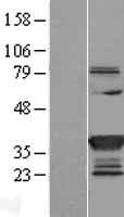 SULT1C2 Human Over-expression Lysate
