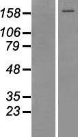 Topoisomerase II alpha (TOP2A) Human Over-expression Lysate