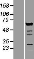 IRF5 Human Over-expression Lysate