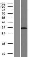 MAGIX Human Over-expression Lysate