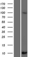 SCGB1C2 Human Over-expression Lysate