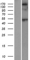 Sarcalumenin (SRL) Human Over-expression Lysate