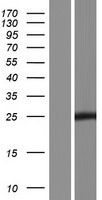 HOATZ Human Over-expression Lysate