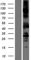 Activin Receptor Type IA (ACVR1) Human Over-expression Lysate