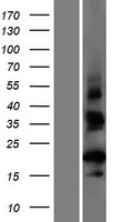 CT62 Human Over-expression Lysate