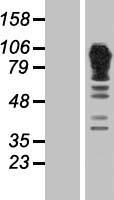 alpha Adducin (ADD1) Human Over-expression Lysate