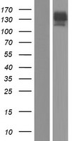 AE binding protein 1 (AEBP1) Human Over-expression Lysate