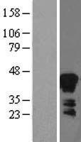 Zinc Alpha 2 Glycoprotein (AZGP1) Human Over-expression Lysate
