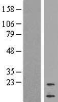 Cortistatin (CORT) Human Over-expression Lysate