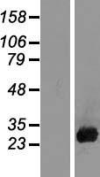Placental lactogen (CSH1) Human Over-expression Lysate