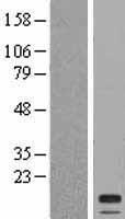 Cystatin SA (CST2) Human Over-expression Lysate