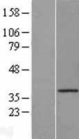 Cathepsin O (CTSO) Human Over-expression Lysate
