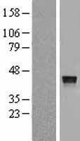 Cathepsin V (CTSV) Human Over-expression Lysate