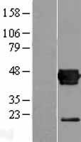 CXADR Human Over-expression Lysate