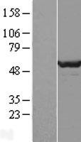 DPH2 Human Over-expression Lysate