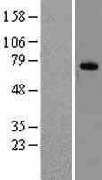 DDX3 (DDX3X) Human Over-expression Lysate