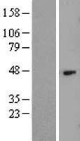 Hyaluronan synthase 1 (HAS1) Human Over-expression Lysate