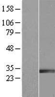 IGFBP7 Human Over-expression Lysate