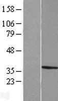 MPPED2 Human Over-expression Lysate