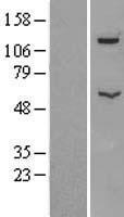 ATP6V1B2 Human Over-expression Lysate