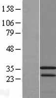 CAMLG Human Over-expression Lysate