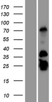 GCAP2 (GUCA1B) Human Over-expression Lysate