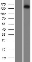 Isoleucyl tRNA synthetase (IARS) Human Over-expression Lysate