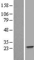 IFNA21 Human Over-expression Lysate