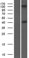 Inhibin beta B (INHBB) Human Over-expression Lysate