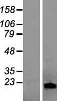 LCN1 Human Over-expression Lysate