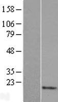 LY6H Human Over-expression Lysate