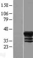 MAGEB4 Human Over-expression Lysate