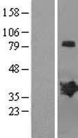 MAGEB2 Human Over-expression Lysate