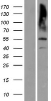 Matrilin 3 (MATN3) Human Over-expression Lysate