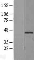 Mannose Phosphate Isomerase (MPI) Human Over-expression Lysate