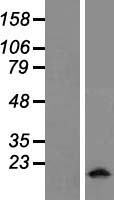 Myosin (MYL5) Human Over-expression Lysate
