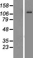 Enterokinase (TMPRSS15) Human Over-expression Lysate