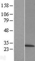 Proteasome 20S beta 6 (PSMB6) Human Over-expression Lysate