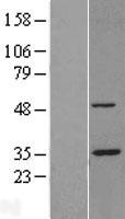 PSMC5 Human Over-expression Lysate
