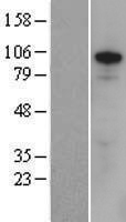 ZFX Human Over-expression Lysate