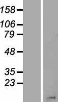 H2BC15 Human Over-expression Lysate