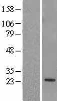 RGS5 Human Over-expression Lysate