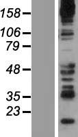 Synaptojanin 2 (SYNJ2) Human Over-expression Lysate