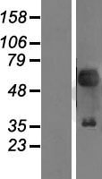 PAX2 Human Over-expression Lysate