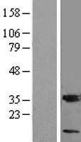 MGST3 Human Over-expression Lysate
