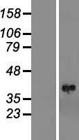 LIMS1 Human Over-expression Lysate