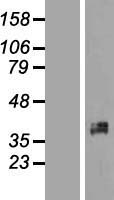 XRCC2 Human Over-expression Lysate