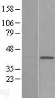 MAB21L1 Human Over-expression Lysate