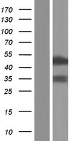 RBM41 Human Over-expression Lysate
